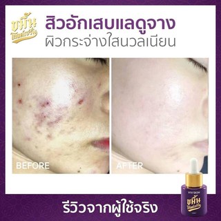 ภาพขนาดย่อของภาพหน้าปกสินค้าขมิ้นโกลด์เซรั่ม By VIV Skin ขนาด 14 ml. จากร้าน beautinsid บน Shopee ภาพที่ 2