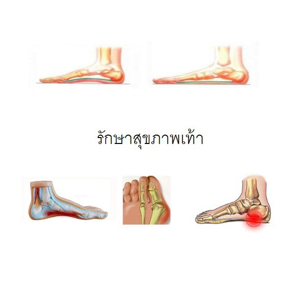 รองเท้าถนอมสุขภาพ-เพื่อสุขภาพเท้าที่ดี-โค้ด-octfash10-ลดทันที10