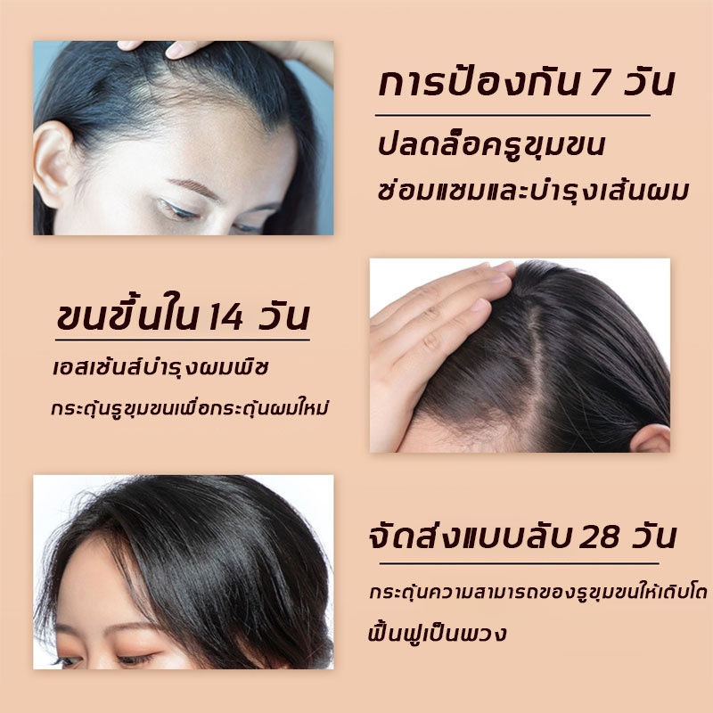 better-2-ขวด-แชมพูขิง-สดชื่นคุมมัน-รากผมแข็งแรง-แก้ปัญหาผมร่วง-ซ่อมแซมผมเสีย-เซรั่มแก้ผมร่วง-เซรั่มปลูกผม-แชมพูแก้ผมร่วง