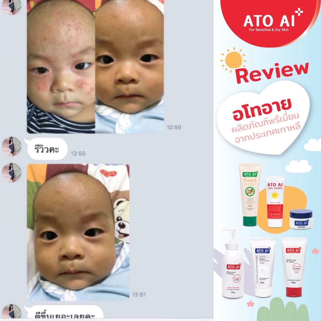 ครีมลดผดผื่น-ผิวแห้ง-ผิวแพ้-ครีมทาผิวเด็ก-อโทอายนำเข้าจากเกาหลี-ใช้ได้ตั้งแต่แรกเกิด-160-กรัม-นำเข้าจากเกาหลี