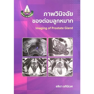 ภาพวินิจฉัยของต่อมลูกหมาก (IMAGING OF PROSTATE GLAND)