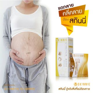 ภาพหน้าปกสินค้าSkinnik เชตท้องลาย ขาลาย ที่เกี่ยวข้อง