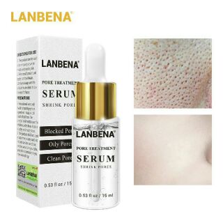 💞พร้อมส่ง💞LANBENA รูขุมขนหดตัว เซรุ่ม ลบสิวหัวดำ การทำให้งาม การดูแลผิว สิว แก่นแท้ serum