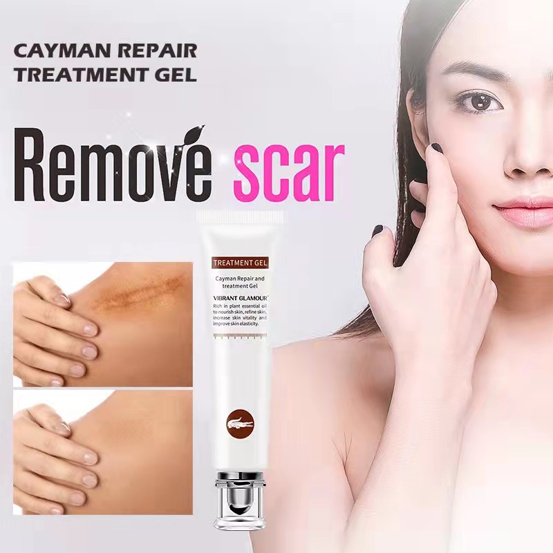 vgเจลลดรอยแผลเป็นสำหรับผิวหน้าลบรอยแผลเป็น-เจลลดรอยแผลเป็น-repair-scar-gel