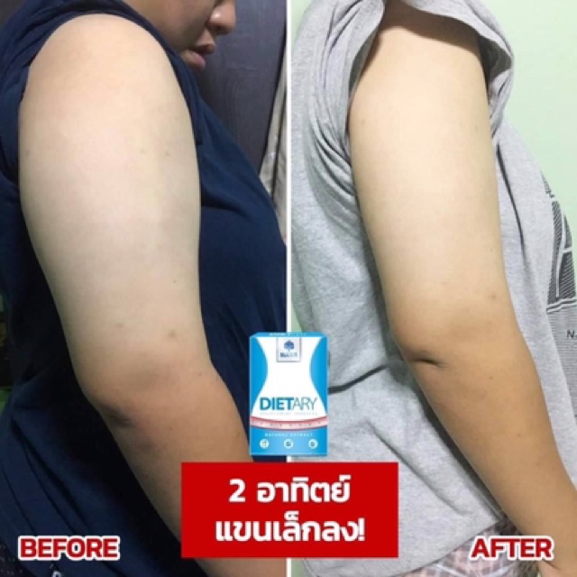 mana-dietary-ผลิตภัณฑ์ลดน้ำหนัก-ของแท้100-พุงยุบ-น้ำหนักลด-ตัวแทนจากบริษัท