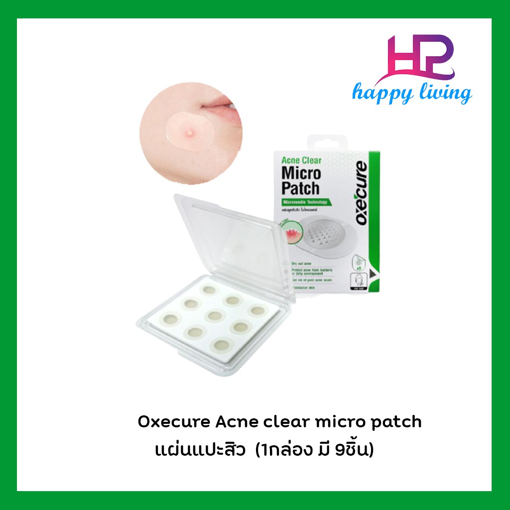 oxecure-แผ่นแปะสิว-ด้วยนวัตกรรม-microneedle-technology-ให้สิวยุบเร็วภายใน-24-ชม