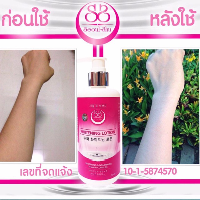 เจลขาว-โซ-ซูseoul-shu-whitening-lotion-เจลขาว-โซ-ซู