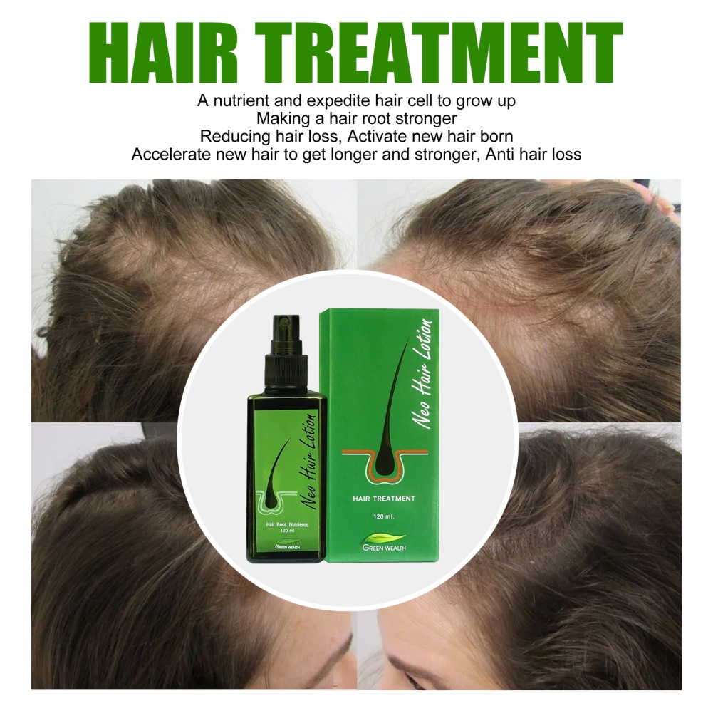 original-thailand-neo-hair-lotion-herbs-hair-growth-serum-hair-loss-treatment-growth-hair-for-men-women-anti-hair-loss-spray-treatment-hair-root-stop-hair-loss-doom