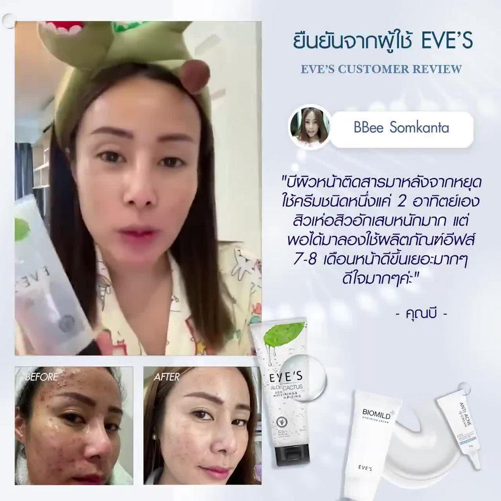 eves-เซตไกลสิว-ช่วยลดสิว-ผิวติดสารอีฟส์-ผิวติดสารสเตียรอยด์-ลดสิว-สิวอักเสบ-สิวอุดตัน-ผดผื่น-ลดอาการบวมแดงจากแสงแดด