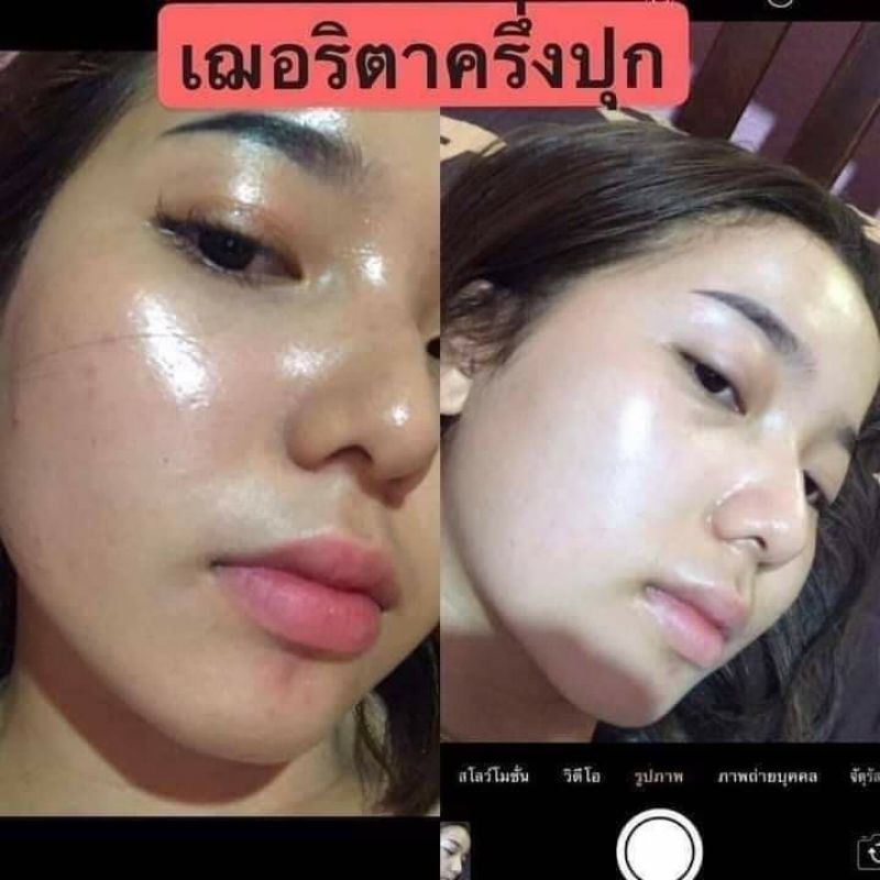 ครีมโสมเฌอริตา-cherritha-ครีมโสมขมิ้นดำ-ส่งของทุกวัน