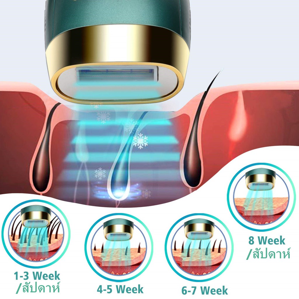 เครื่องกำจัดขน-เครื่องเลเซอร์กำจัดขน-ipl-อุปกรณ์กำจัดขนด้วยเลเซอร์จุดเยือกแข็ง-เลเซอร์กำจัดขน