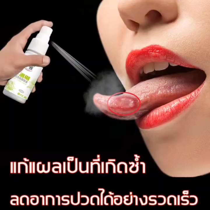 ครีมทาแผลในปาก-แผลร้อนใน-ครีมต้านแบคทีเรีย-เพื่อสุขภาพช่องปากที่แข็งแรง-ลดปัญหาในช่องปากให้ความรู้สึกถึงความสะอาด-ยาสีฟั