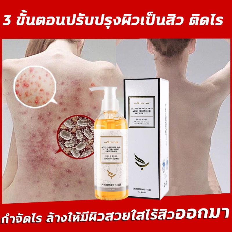 เจลอาบน้ำ-สบู่อาบน้ำครีมอาบน้ำ-ครีมอาบน้ำหอมๆ260ml-ครีมอาบน้ำ-โฟมเยอะ-อ่อนโยนไม่ระคายเคือง