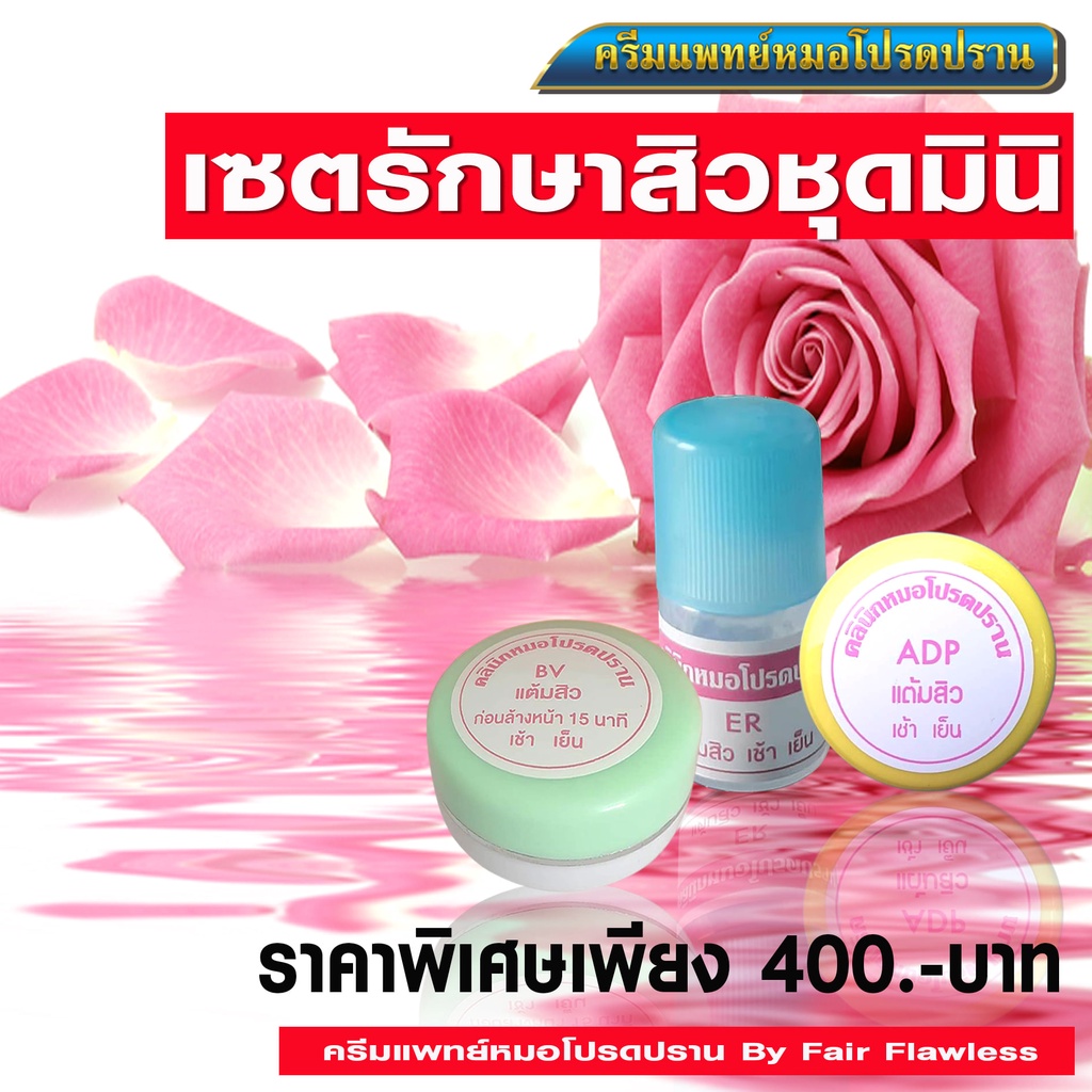 เซตรักษาสิวชุดมินิ-จัดส่งฟรี-ครีมแพทย์หมอโปรดปราน