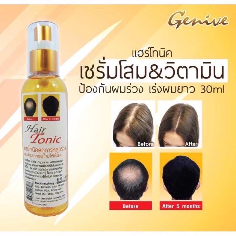 แฮร์โทนิคจีนีวี่-ลดผมร่วง-เร่งผมยาว-บำรุงรากผม-ปลูกผม-hairtonic-genive-120มล-ของแท้