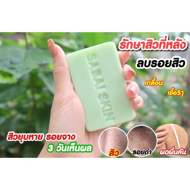 no-box-สบู่ลดสิวหลัง-สบู่ลดสิวที่หน้า-สบู่สิว-สบู่ผิวขาว