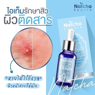 เซรั่มสลายฝ้า ณัชชา Natcha White Serum (1 ขวด)กู้หน้าพังปรับผิวขาวขึ้น10เท่าฟื้นฟูผิวเเละ ลดรอยด่างดำเกิดที่จากสิวและฝ้า