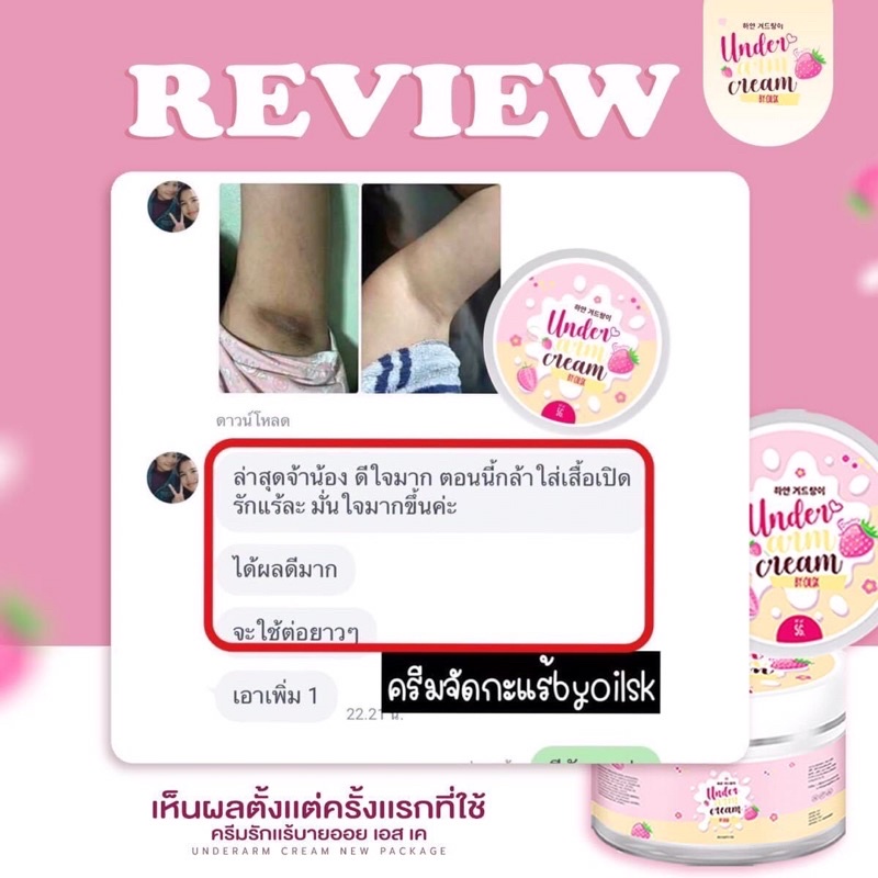 ครีมรักแร้ขาวบายออย-ลดกลิ่นเต่า-โชว์วงแขนขาวกระจ่างใส-ลดตุ่มหนังไก่ได้-ของแท้