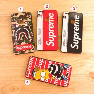 Huawei P10 lite เคสขอบนิ่มเส้นนูน Supreme
