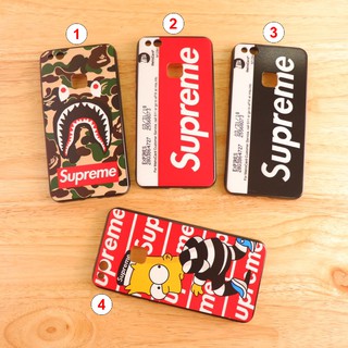 Huawei P10 lite เคสขอบนิ่มเส้นนูน Supreme