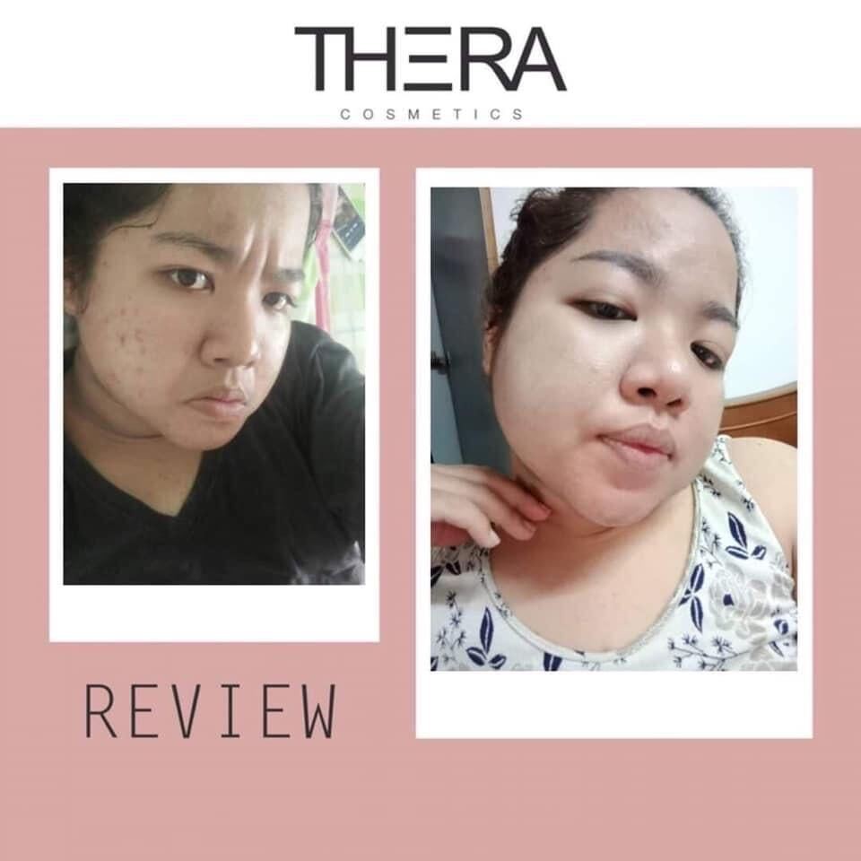 thera-เธอร่า-อินเทนซีฟ-ไวท์เทนนิ่ง-ครีมบำรุงผิวหน้า-สีครีมออร่าอมชมพู-ครีมเทอร่า-เทอร่า