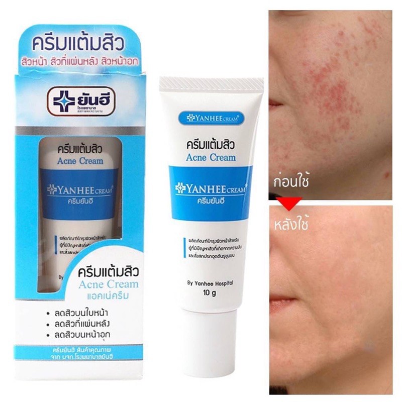 yanhee-acne-cream-ครีมแต้มสิวครีมยันฮี-10-g