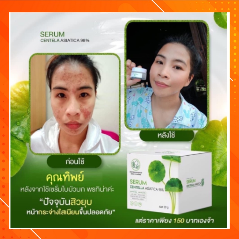 เซรั่มใบบัวบก-amp-สบู่หน้าเงา-ลดสิว-หน้าใส-ลดฝ้ากระ-ผิวแพ้ง่าย-แพ้ครีม-เซรั่มพรทินา-ฟื้นฟูผิวให้แข็งแรง