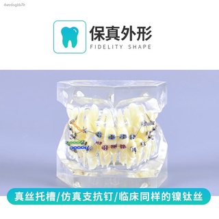 ❖◇♤&gt; การแสดงการแก้ไขการคลาดเคลื่อน Tashi Bracket Orthodontic Oral Model Transparent Teeth Model Dental Teaching Model &lt;