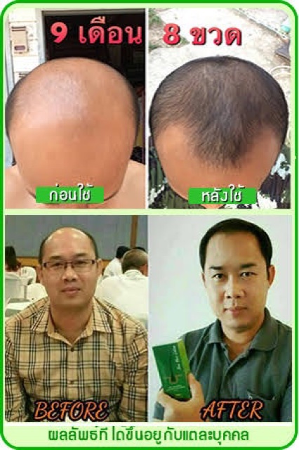 นีโอแฮร์โลชั่น-neohair-ของแท้100-ของใหม่ล่าสุด