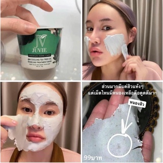 พร้อมส่ง ❤️‍🔥JUVIE Mask (จูวี่มาร์ก) มาร์กหน้าใส ลดสิว รักษาสิวอุดตัน มาร์กหน้าสูตรคลีนิค ปลอดภัย มี อย. ของแท้100%