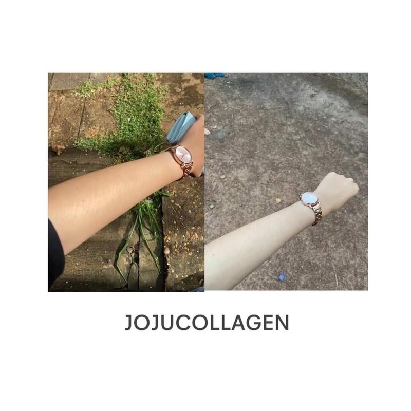โจจูคลอลาเจน-1-กระปุก-joju-collagen-คลอลาเคเคี้ยวได้-อมได้-ผิวสวย-กระจ่างใส-ช่วยเติมน้ำให้ผิว-ดูเนียนนุ่มอิ่ม