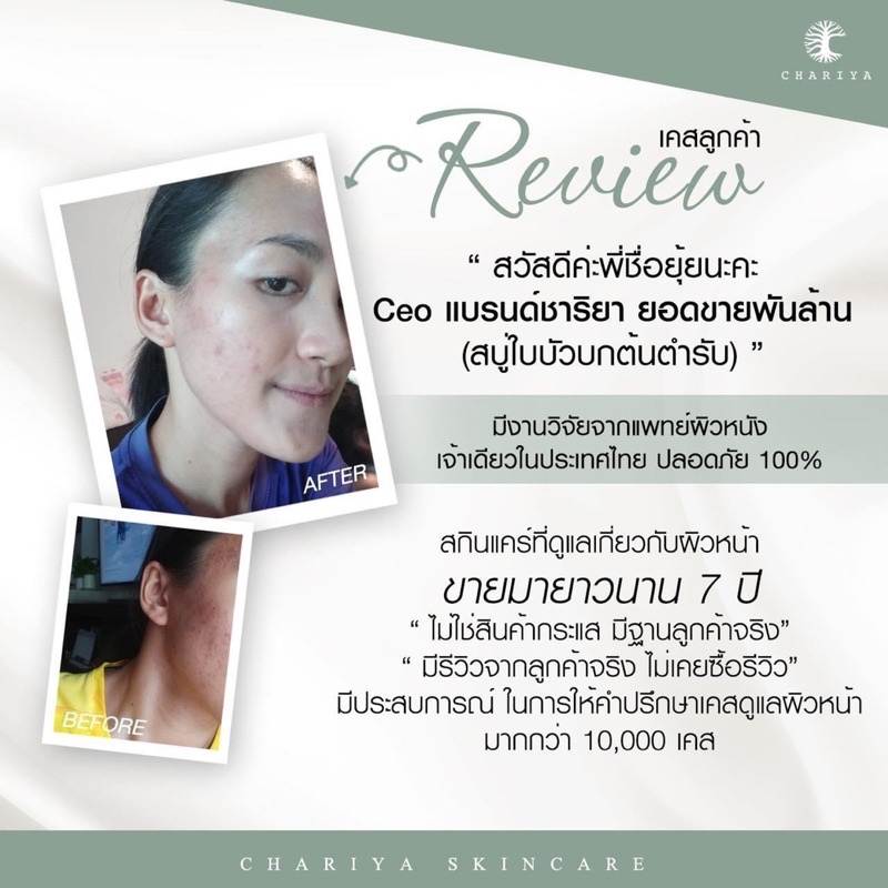 ส่งฟรี-ชาริยา-เซตรักษาสิว-หลุมสิวตื้นขึ้น-หน้าขาวใส-เซรั่มชาริยา-เซรั่มลดสิว-ครีม-ครีมหน้าสวย-ครีมชาริยา