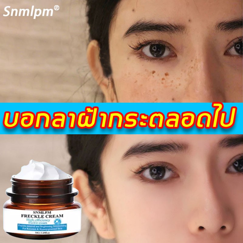 ซื้อ2-แถม1-ครีมทาฝ้าลึก30gวัตถุดิบนำเข้าจากฝรั่งเศส-ละลายคราบจุดด่างดำ-ครีมทาฝ้าหนาๆ-ครีมทาฝ้ากระ-ครีมทาฝ้ากะ-ครีมทาฝ้า