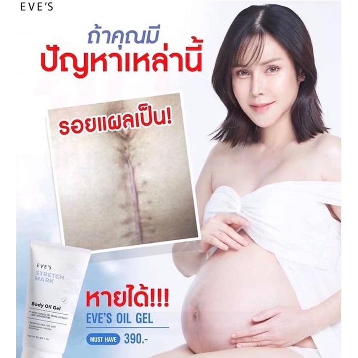 eves-อีฟส์ออยด์เจล-ครีมทาท้องแตกลาย-ลดรอยแตกลาย-เพิ่มความชุ่มชื้น-ลดจุดด่างดำ