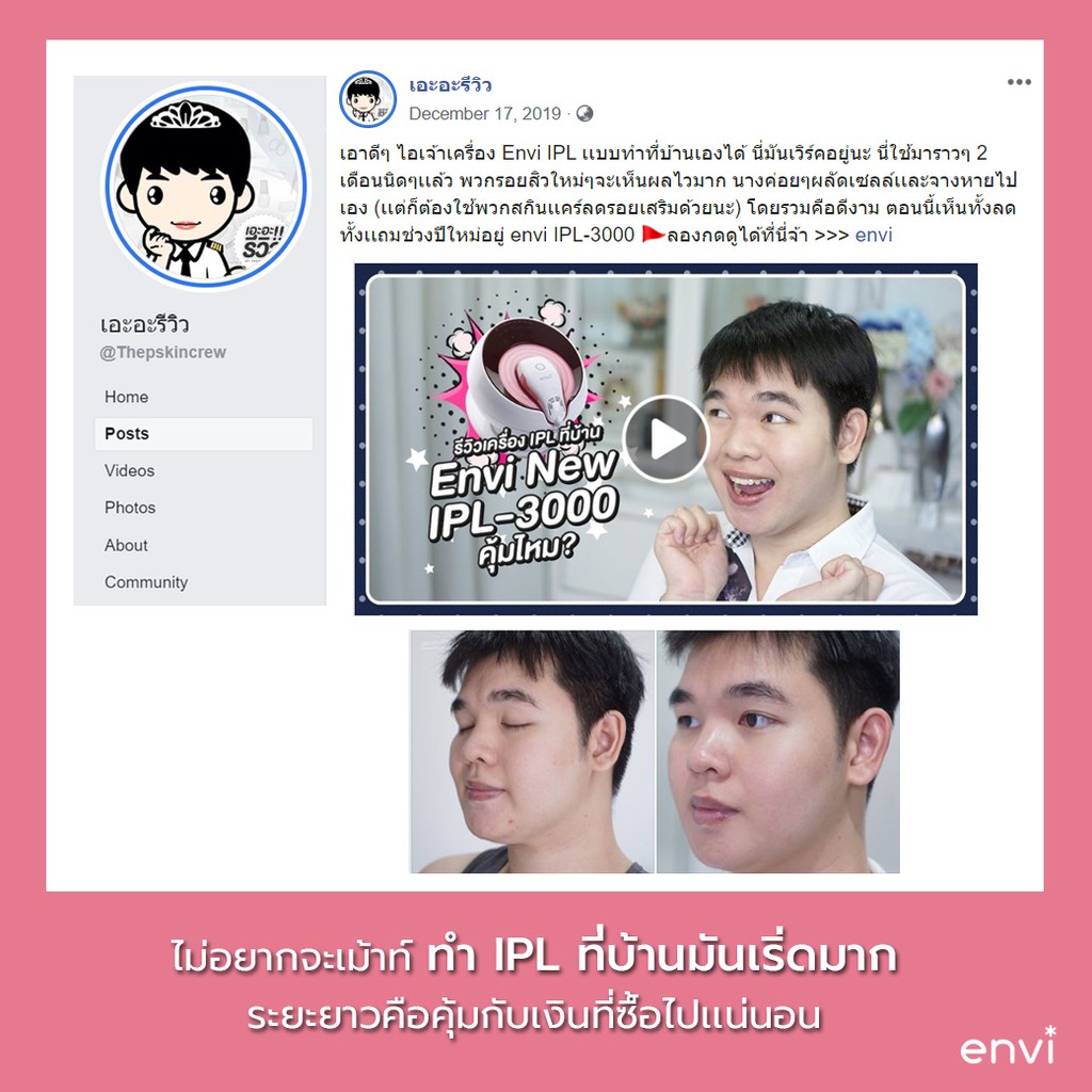 เครื่อง-ipl-แบบใช้ที่บ้าน-ใหม่ล่าสุด-นวัตกรรมความงามที่ดีที่สุด-ผลลัพธ์การรักษาเทียบเท่าคลินิก