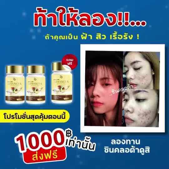 sale-3-วันเท่านั้น-ซินคลอต้า-zinclota-โปรขายดี-2-แถม-1-มีเก็บปลายทาง