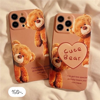 เคสโทรศัพท์ เคสแถมไอริง เคสแถมGriptok เคสแถมที่ติด 🐻 ไอริงcute beer