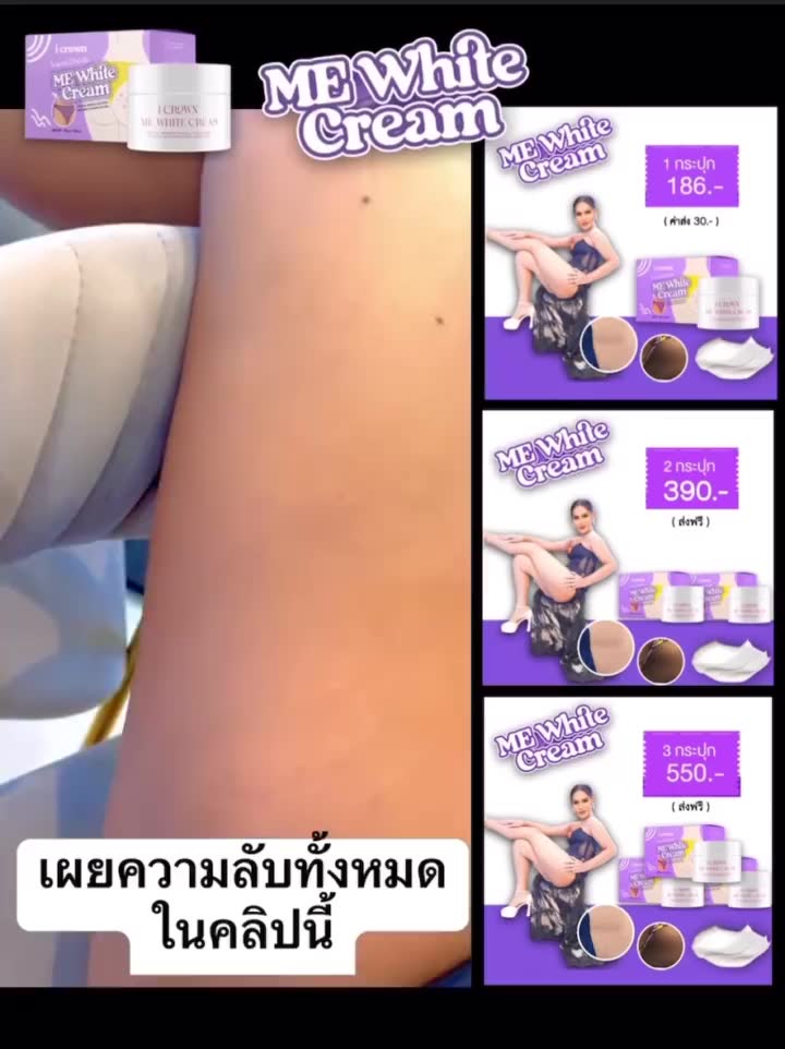 ครีมทาง่ามขาครีมแอนนา-me-white-cream-มีไวท์ครีม-ครีมแอนนา-ปัญหาหมองคล้ำ-ขาหนีบดำ-รักแร้ดำ-ง่ามขาดำ-ข้อศอกดำ-ขนาด-30-g