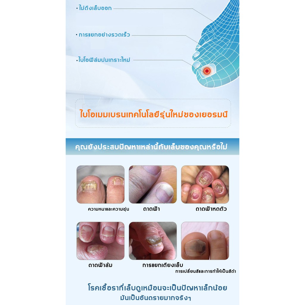 clothesofskin-เซรั่มรักษาเล็บ-ซ่อมแซมเล็บ-รักษาเล็บ-เซรั่มเล็บ-ดูแลเล็บ-ซ่อมเล็บที่ชำรุด-เซรั่มบำรุงเล็บ-รักษาเล็บเสีย