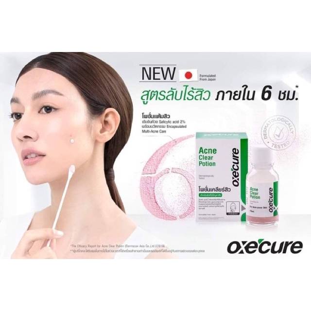 oxe-cure-acne-clear-potion-อ๊อกซีเคียว-แอคเน่-เคลียร์-โพชั่น-แต้มสิว-รักษาสิว-บำรุงผิวหน้า-ขนาด-15-ml-1-ขวด