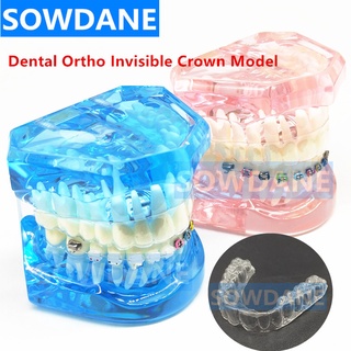 New Dental Orthodontic Tooth Model for Patient Communication Dental Study Teeth Model with Invisible Transparent Crown B