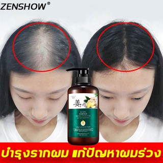 ZENSHOW แชมพูขิงเพียว 500ml สดชื่นคุมมัน รากผมแข็งแรง แก้ปัญหาผมร่วง แชมพูแก้ผมร่วง ยาสระผมแก้ร่วง แชมพูปลูกผมดก