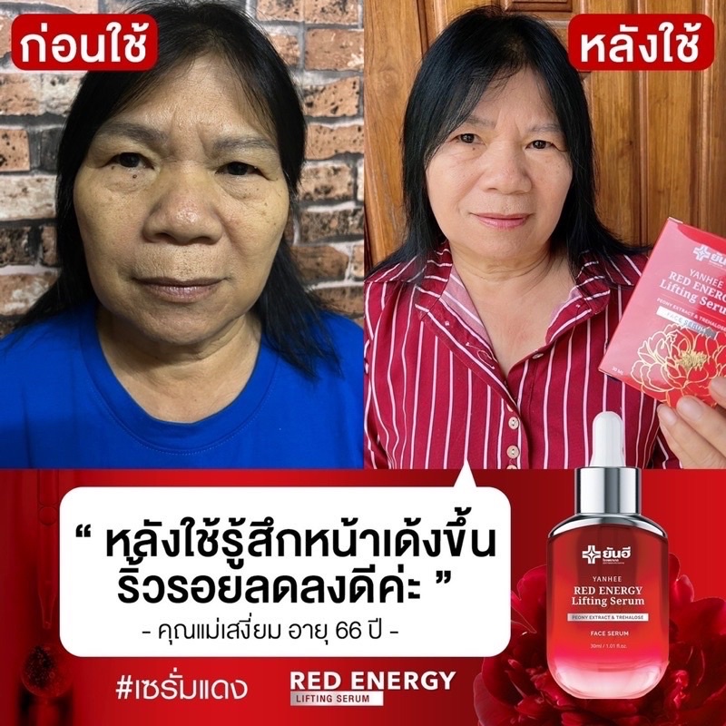 ส่งฟรี-มีปลายทาง-เซรั่มยันฮี-เรด-เอนเนอร์จี-red-energy-lifting-serum-ของแท้จากบริษัทยันฮี-เซรั่มหน้าเด้ง-เรดเซรั่ม