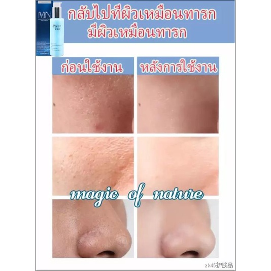 yiyan-รูขุมขนหดตัวสาระสำคัญ-120ml-รูขุมขนกระชับขึ้-เซรั่มกระชับใบหน้า-รูขุมขนหดตัว-เซรั่มไฮย