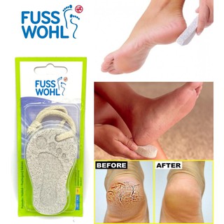 Fuss wohl แปรงขัดส้นเท้า ขัดเท้าแห้ง ส้นเท้าแตก ผลัดเซลผิวเท้า หินแท้