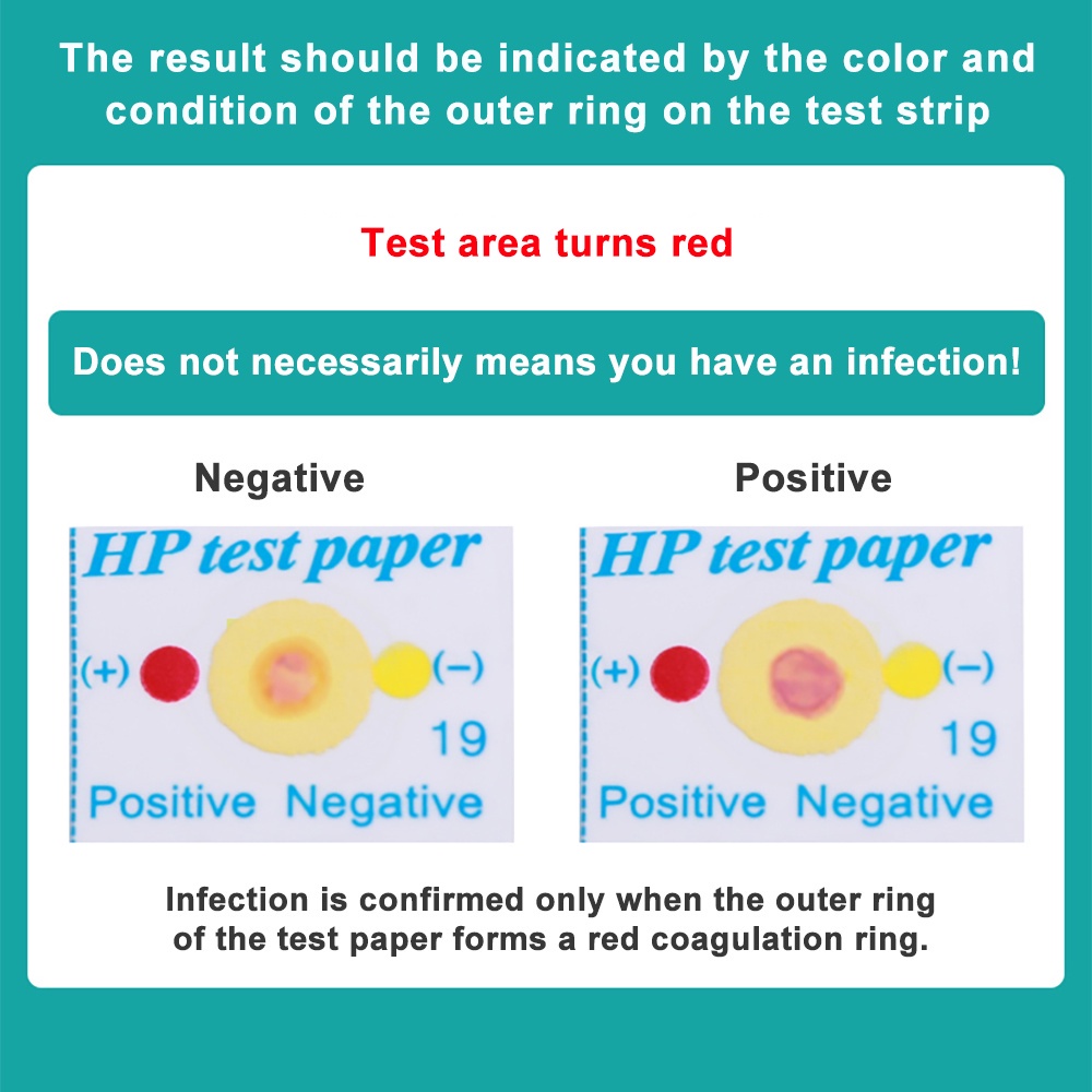 cofoe-กระดาษทดสอบไพลอรี่-กระเพาะอาหาร-กระเพาะอาหาร-โรคฮาลิโตซิส