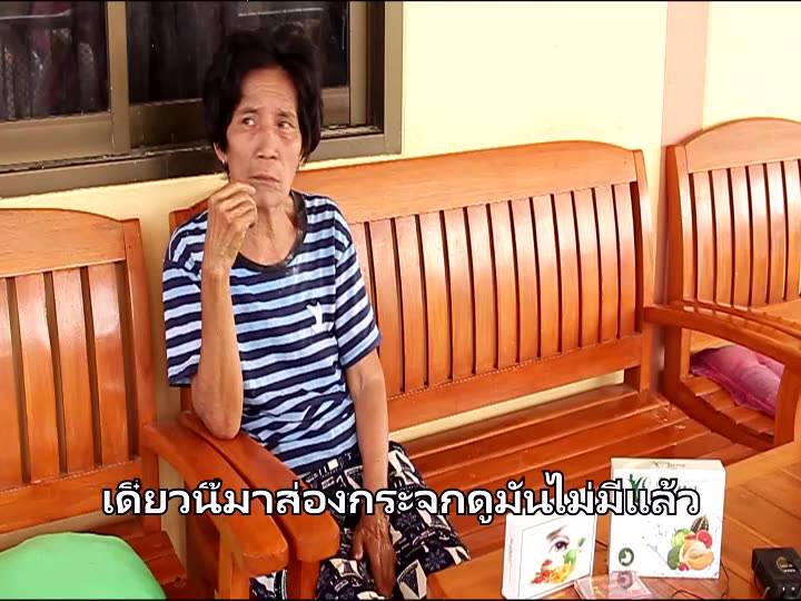 จิมบาน่า-พลัส-2-ผลิตภัณต์เสริมอาหาร-สำหรับดวงตา-ต้อเนื้อ-ต้อกระจก-ต้อลม-ดีคอนแทค