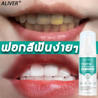 ALIVER มูสแปรงฟัน 60ml โฟมละเอียด ทำความสะอาดปาก 360 ° ลมหายใจสดชื่น เซรั่มฟอกฟันขาว มูสแปรงฟันขาว น้ำยาฟอกสีฟัน ยาสีฟัน