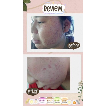 ครีมโบวี่คิ้ม-bowvy-kim-ลดสิว-ฝ้า-ผิวหมองคล้ำ-ให้ขาวกระจ่างใสแท้10000