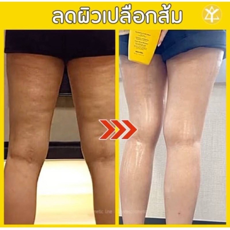 ครีมลดผิวเปลือกส้ม-vitamin-dr-body-lotion-medi-peelแท้น้าาา